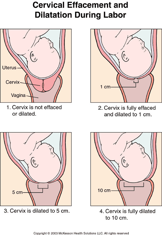 dilating cervix